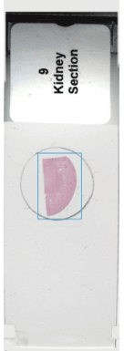 Kidney Section